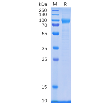 Human GPC3 Protein, hFc Tag