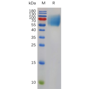 Human CD59 Protein, hFc Tag