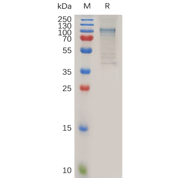 Human OSMR Protein, His Tag