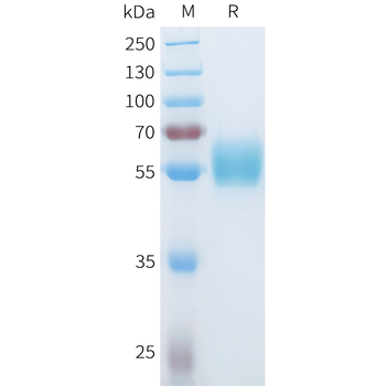 Mouse CD22 Protein, His Tag