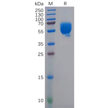 Human CD52 Protein, hFc Tag