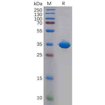 Human CD106 Protein, His Tag