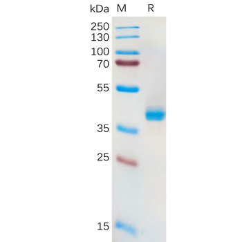 Human LIV-1 Protein, His Tag