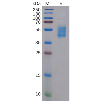 Human MMP9(20-707) Protein, His Tag