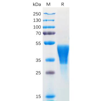Human PRLR Protein, hFc Tag