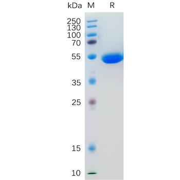 Human MMP9(20-469) Protein, His Tag