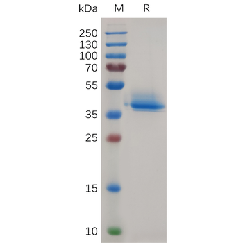 Human CD305 Protein, hFc Tag
