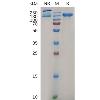 Human TGFB2 Protein, hFc Tag