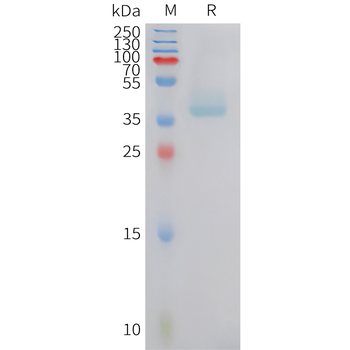 Human CCL14 (C-6His) Protein