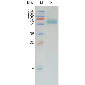 Human CXCL3 (N-6His) Protein