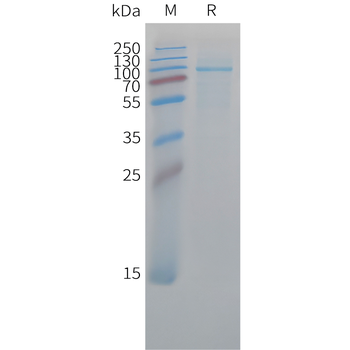 Human Noggin (C-Fc) Protein