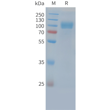 Human IL-10RB (C-Fc) Protein