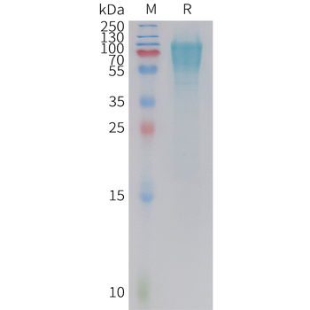 Human TPO (N, C-6His) Protein