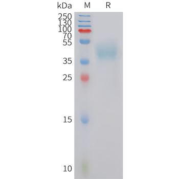 Human IL-15 Protein