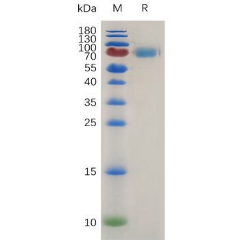 Human PDGFD(19-370) Protein, His Tag