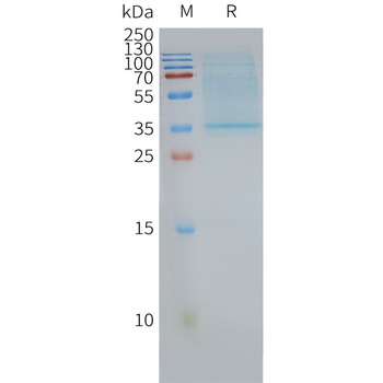 Human CD63 full length protein-synthetic nanodisc