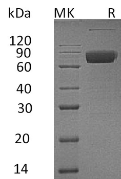 Human IL12A and IL12B Heterodimer Protein, hFc Tag and His Tag