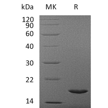 Human DKK1 Protein, His Tag