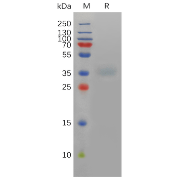 Human ACHE Protein, His Tag