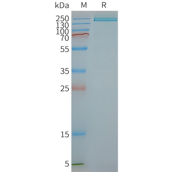 Human PLA2R1 full length protein-synthetic nanodisc