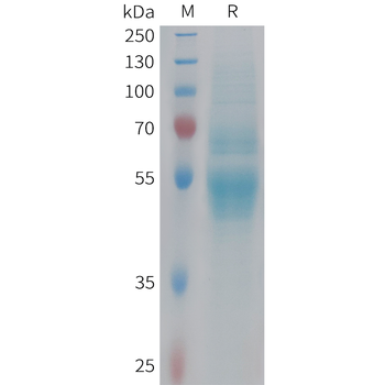 Cynomolgus B7-H3 Protein, His Tag