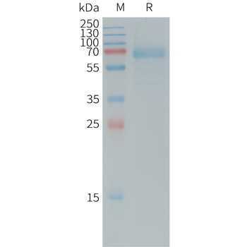Human IL31RA Protein, His Tag