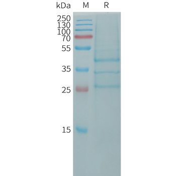 Human CCN2 Protein, hFc Tag