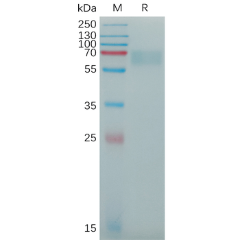 Human PDGFRA Protein, His Tag