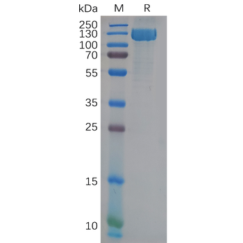 Human MUC16(13810-14451) Protein, His Tag
