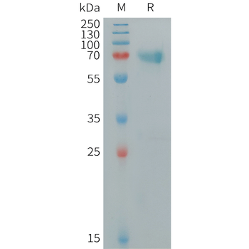 Human APOH Protein, His Tag