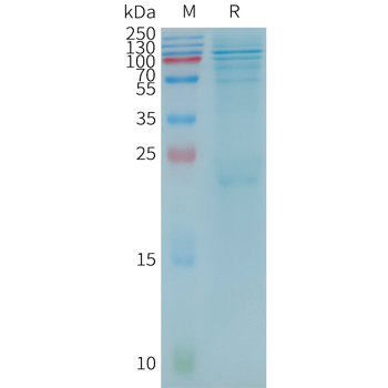 Human MAG Protein, His Tag