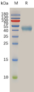 Human MERTK Protein, His Tag