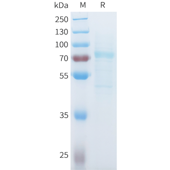 Mouse GUCY2C Protein, His Tag