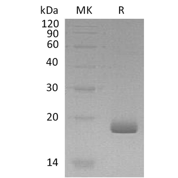 Human MELTF Protein, His Tag