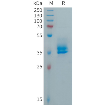 Human ADIPOQ Protein, hFc Tag
