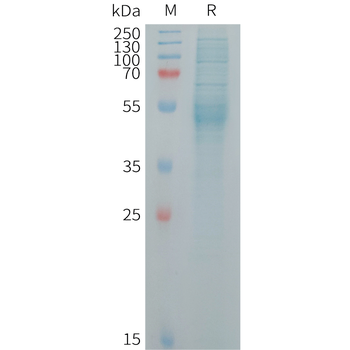 Human HER3(544-643) Protein, mFc Tag