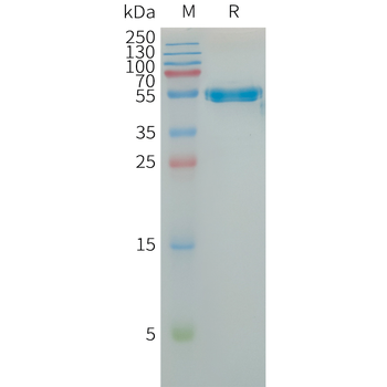Human HER3(544-643) Protein, hFc Tag
