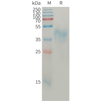 Human LRP5 Protein, hFc Tag