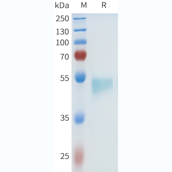 Mouse FCRL5 Protein, His Tag