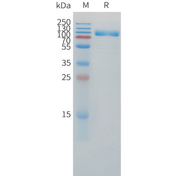Cynomolgus LIV-1 Protein, hFc Tag