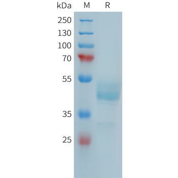 Human IL31RA Protein, mFc Tag