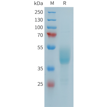 Human IL31RA Protein, hFc Tag