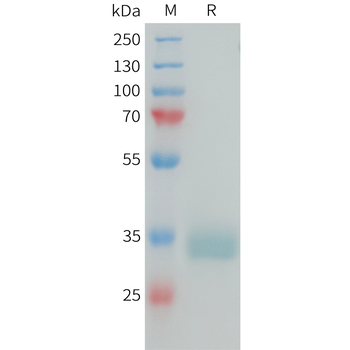 Human ROR2(304-403) Protein, hFc Tag