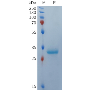 Human DLL3(27-175) Protein, N-MBP Tag and C-10×His tag