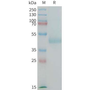 Human TNFSF15 Protein, His Tag