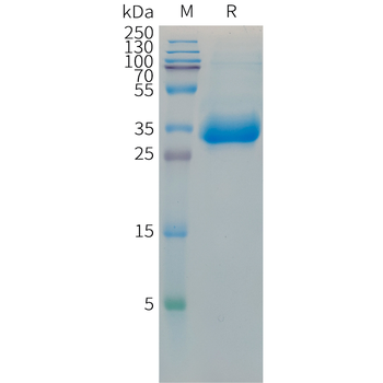 Human EDNRB Protein, hFc Tag
