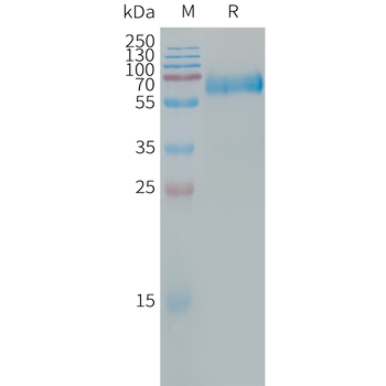 Human CCL7 Protein, hFc Tag