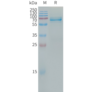 Human IL29 Protein, hFc Tag