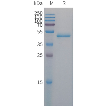 Human DKK3 Protein, hFc Tag