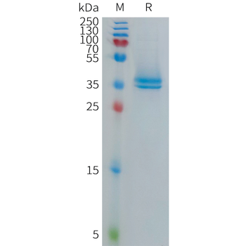 Human MAPT Protein, His Tag